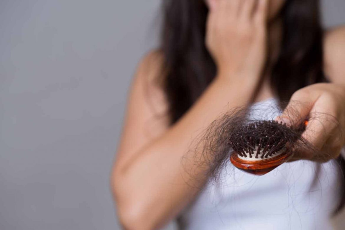 How to deal with hair loss